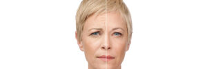 woman with wrinkles before and after