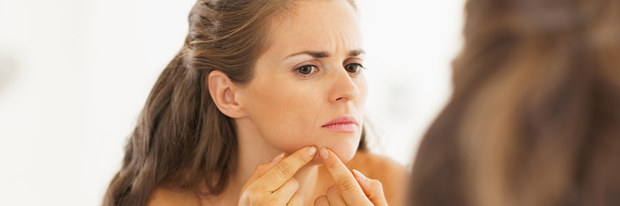 Acne Treatments