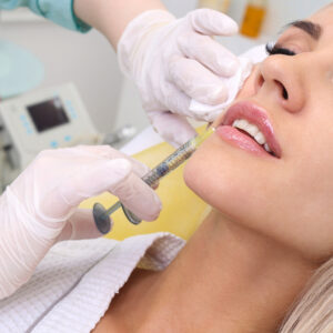 Juvederm