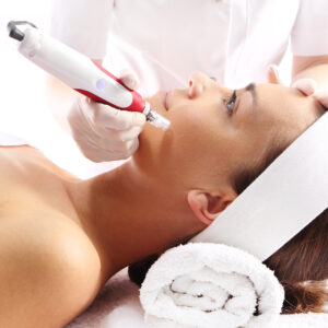 Microneedling