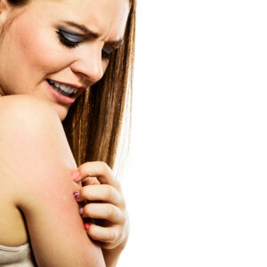 Allergic Reaction