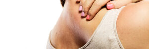 Dermatitis