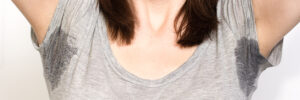 Excessive Sweating (Hyperhidrosis)