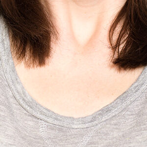 Botox for Hyperhidrosis