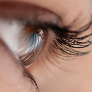Thinning Eyelashes