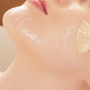Peels