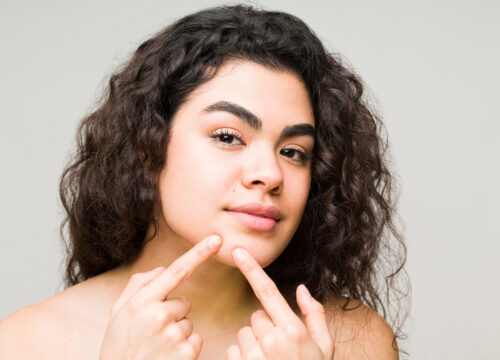 Photo of a young woman with curly, dark hair touching a pimple on her face