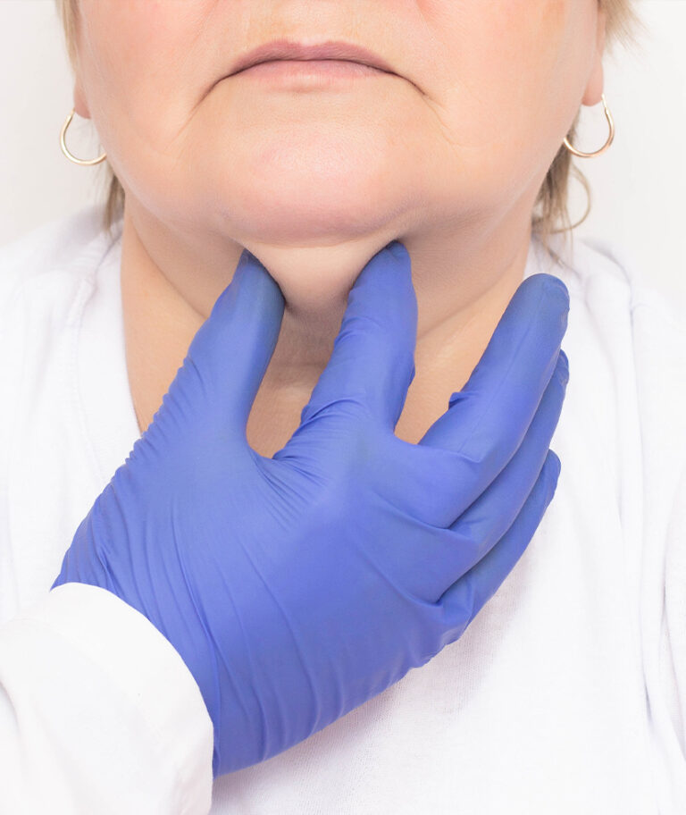 Double Chin Treatments McLean & Potomac Dermatology