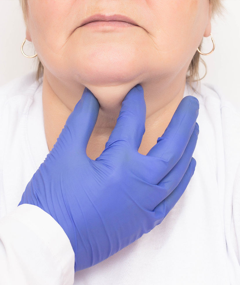 Photo of a doctor pinching the submental fat on a woman's neck area