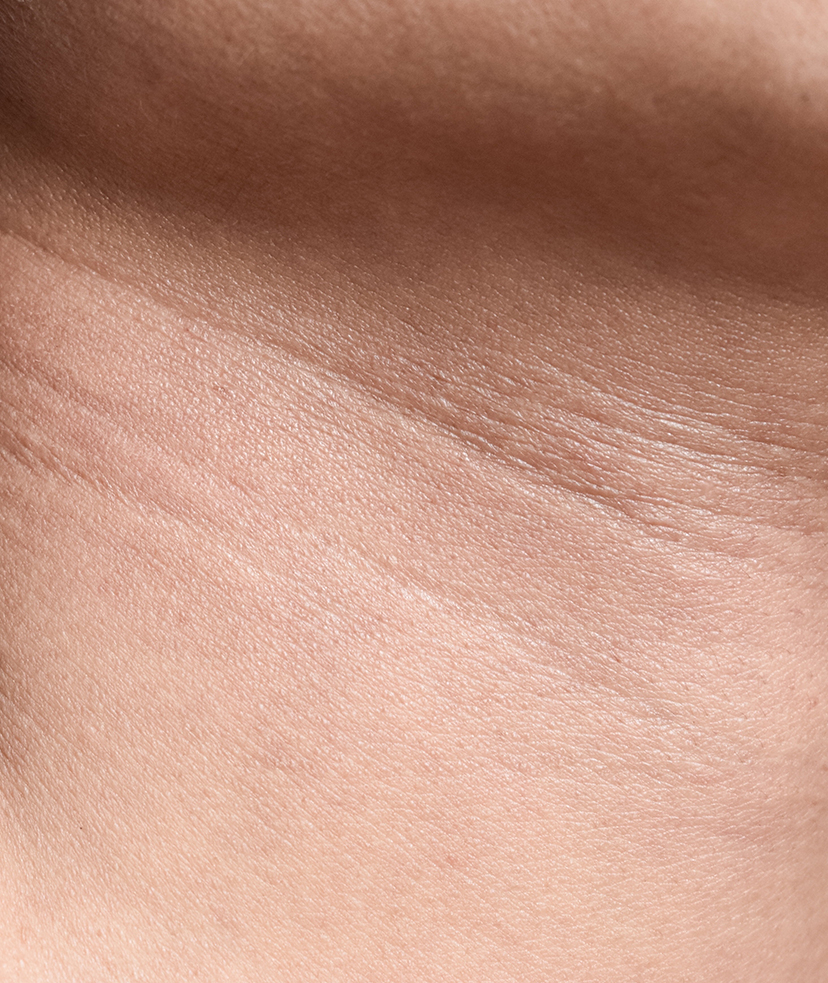 Close-up photo of neck lines on a person's body