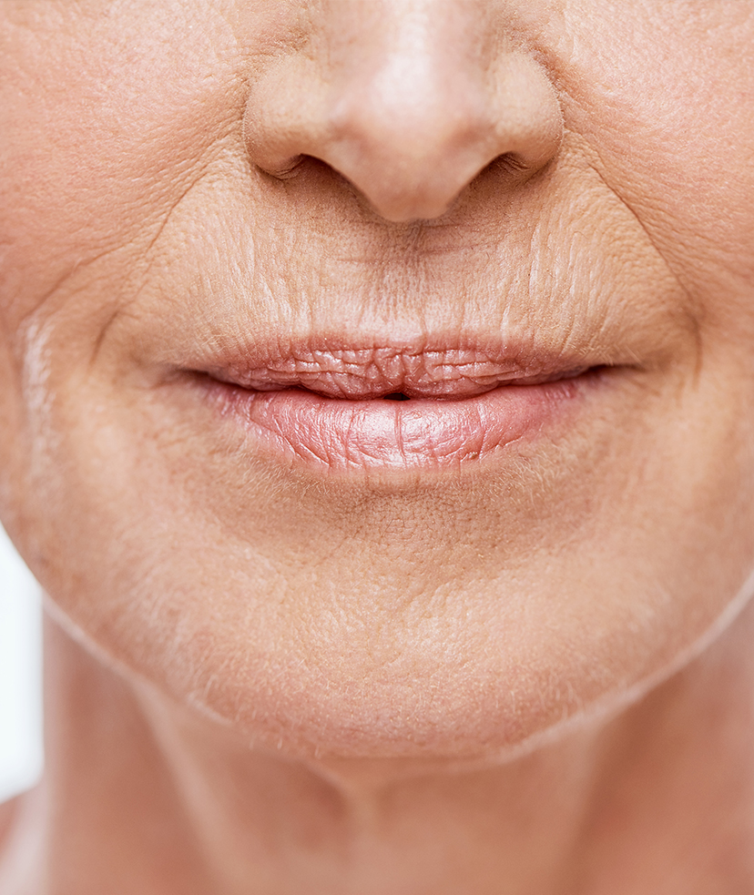 Close-up photo of wrinkles on a woman's face