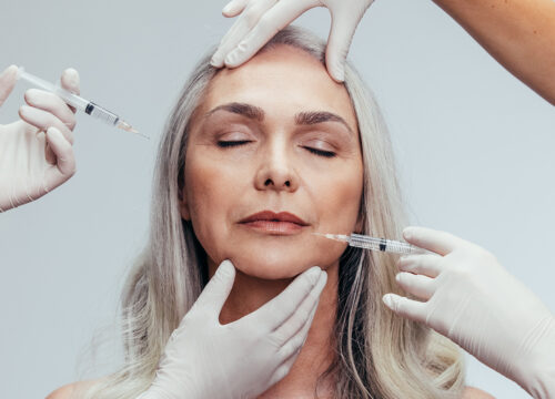 Photo of a woman receiving a facelift by syringe