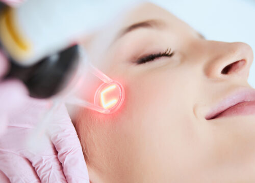 Photo of a woman receiving fractional laser treatments on her face