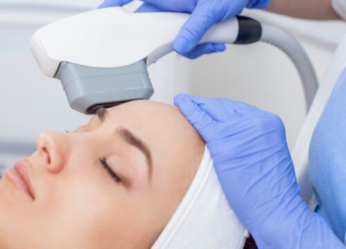 Photo of a woman receiving an IPL photofacial