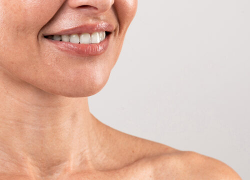 Photo of a woman's lower face, neck, and neck lines