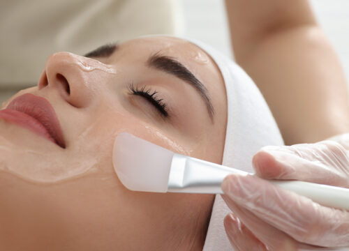 Photo of a woman receiving a chemical peel