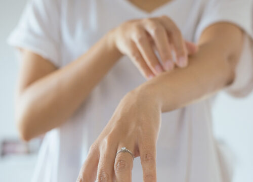 Photo of a woman itching her arm