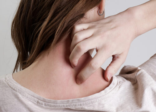 Photo of a woman scratching the back of her neck