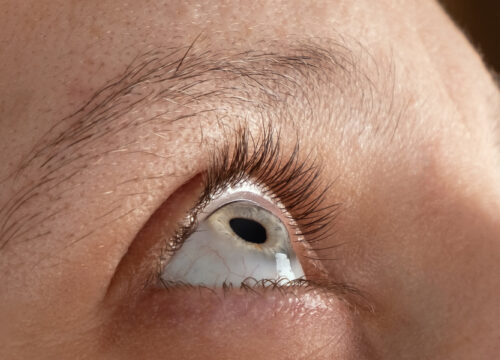 Photo of a person's eye looking up