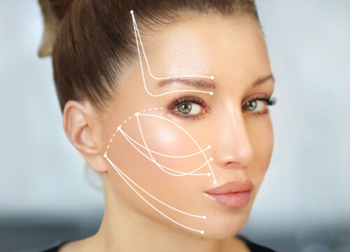 Photo of a woman with lines on her face for a thread lift