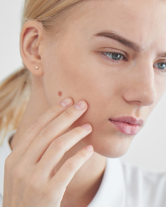 Photo of a blonde woman with a mole on her face