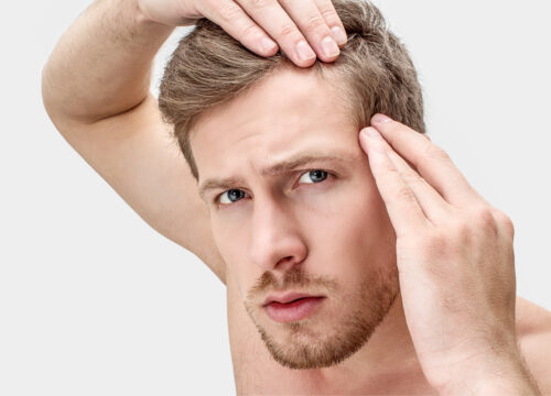 Photo of a man with blond, short hair touching his hairline