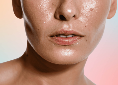 Oily Skin: Does It Age Better?