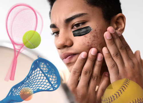 Teen Acne: A Playbook for Athletes