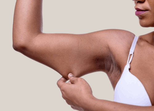 How To Fix Ozempic Arms